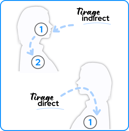 Sch&eacute;ma expliquant la diff&eacute;rence entre tirage direct (MTL) et tirage direct (DL).
